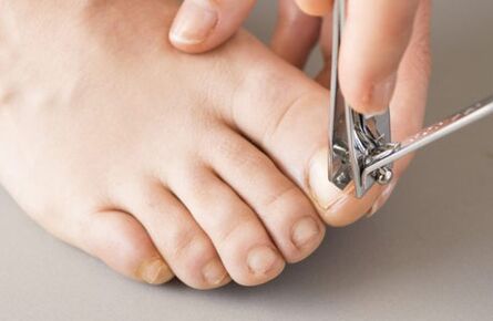 The causes of fungus on the nails