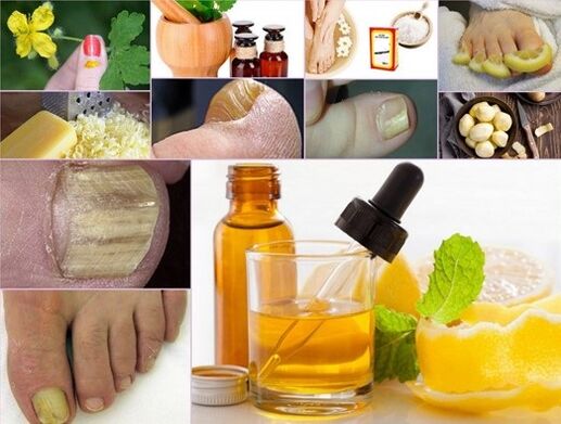 Home remedies to treat toenail fungus.