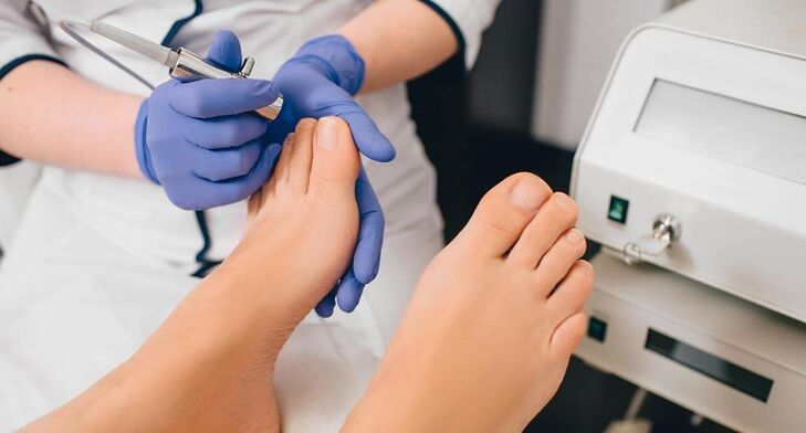 Professional treatment for toenail fungus.